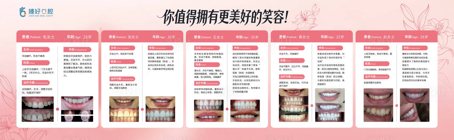 源文件下载【享设计】搜索编号：48670034741223938【牙齿贴面案例展板】