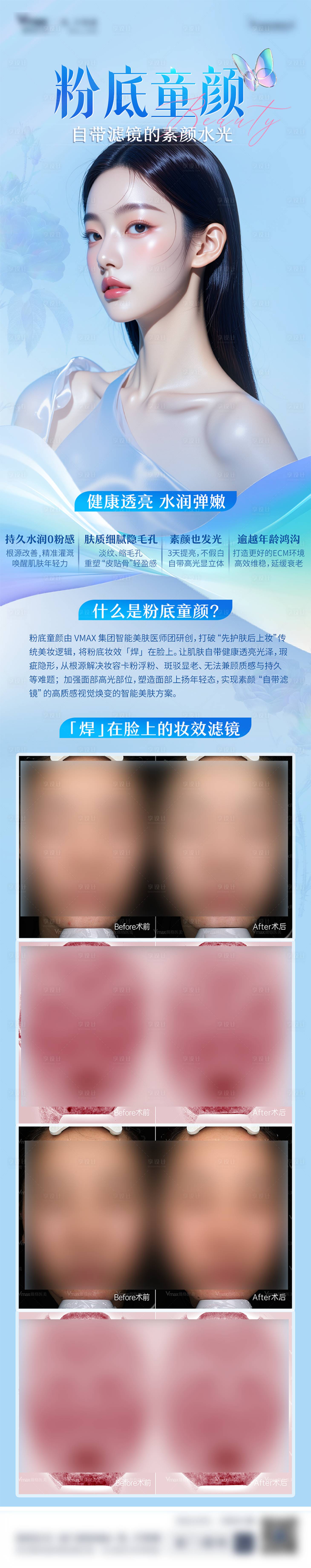 源文件下载【享设计】搜索编号：27110034608457090【医美童颜针胶原蛋白抗衰水光针长图案例】