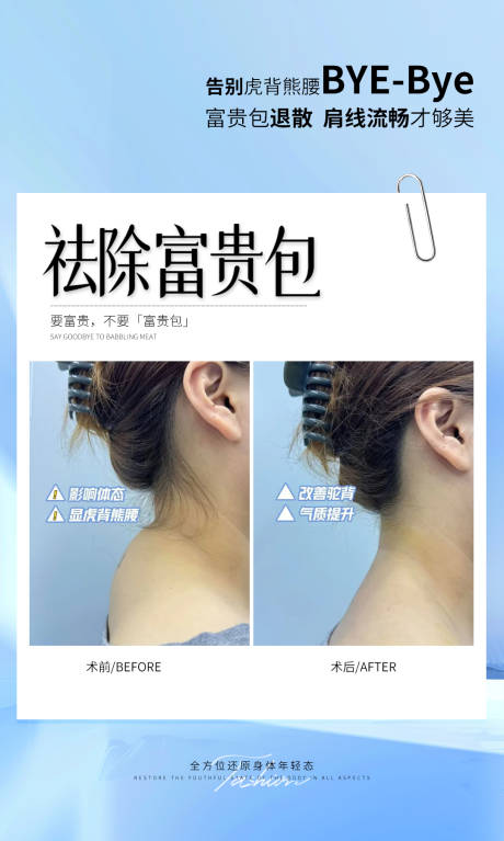 源文件下载【享设计】搜索编号：87770034288693761【祛富贵包】