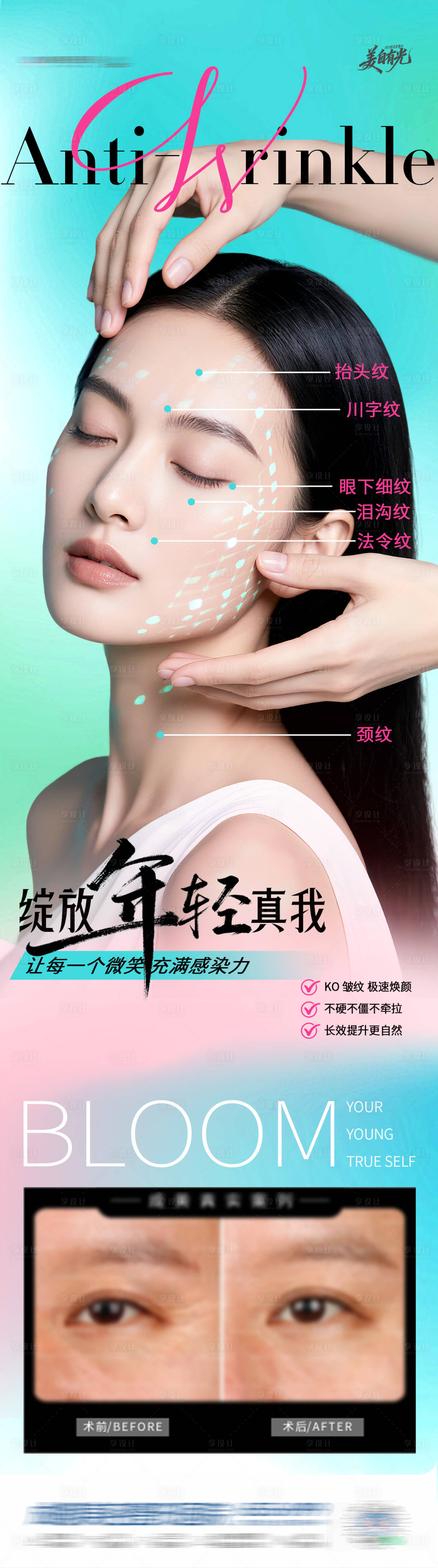 源文件下载【享设计】搜索编号：98520034607888256【医美除皱抗衰创意海报】