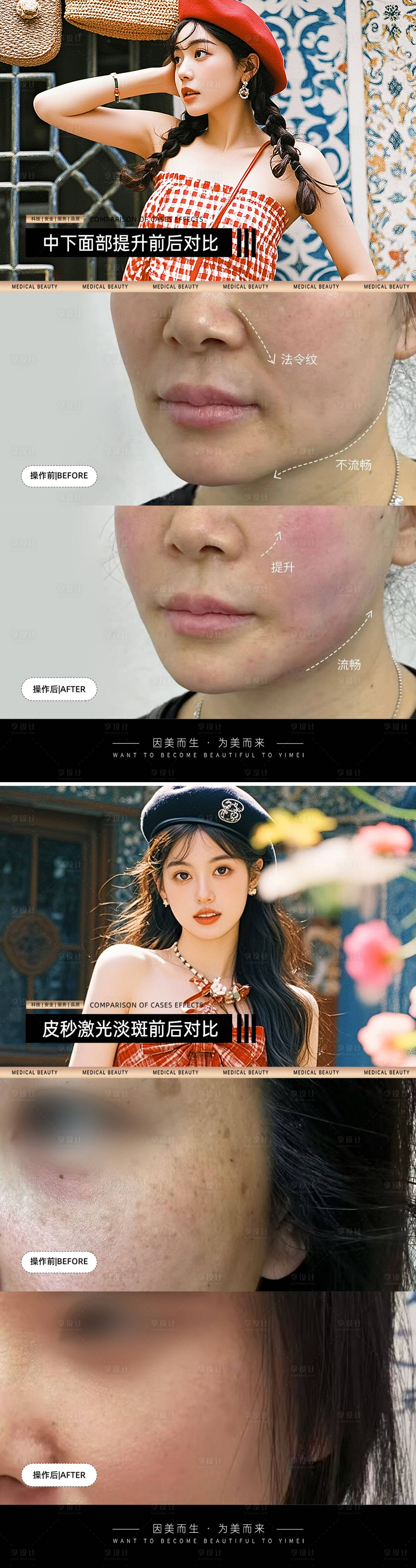 源文件下載【享設計】搜索編號：67100034320649610【醫(yī)美案例對比模板】