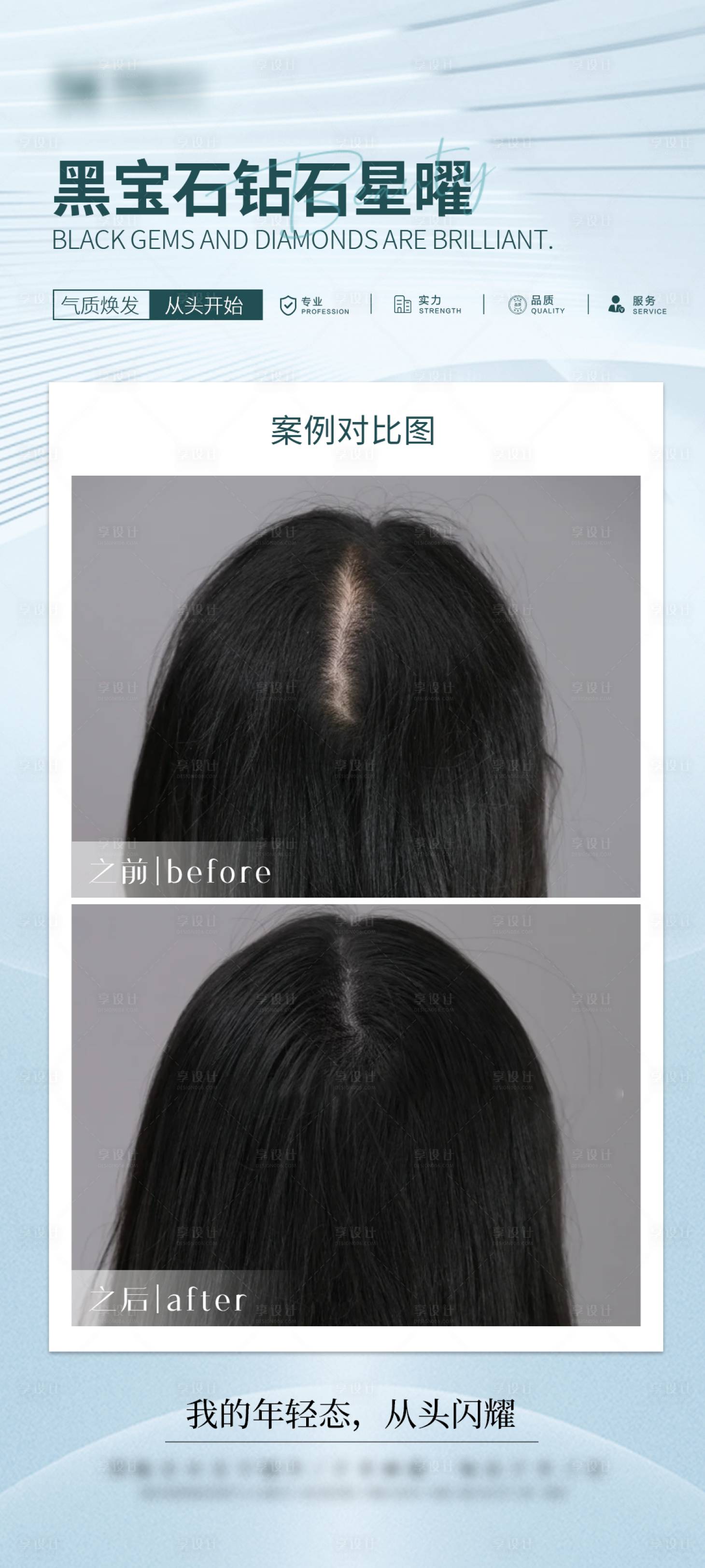 源文件下載【享設計】搜索編號：15350034474714140【醫美頭皮抗衰案例海報】