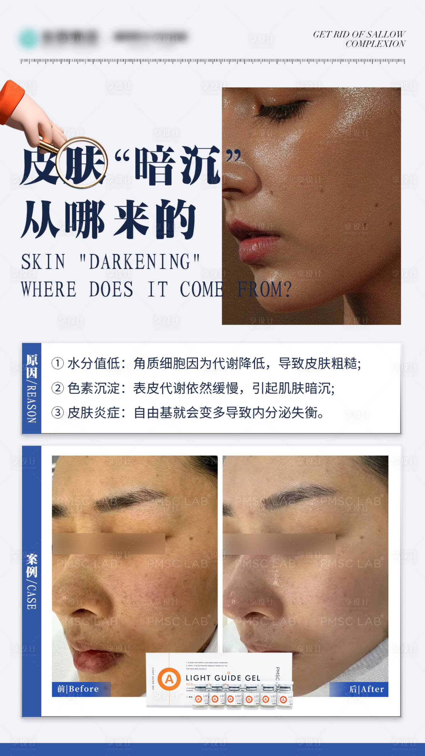 源文件下载【享设计】搜索编号：72820034393234138【祛除暗黄案例分享】