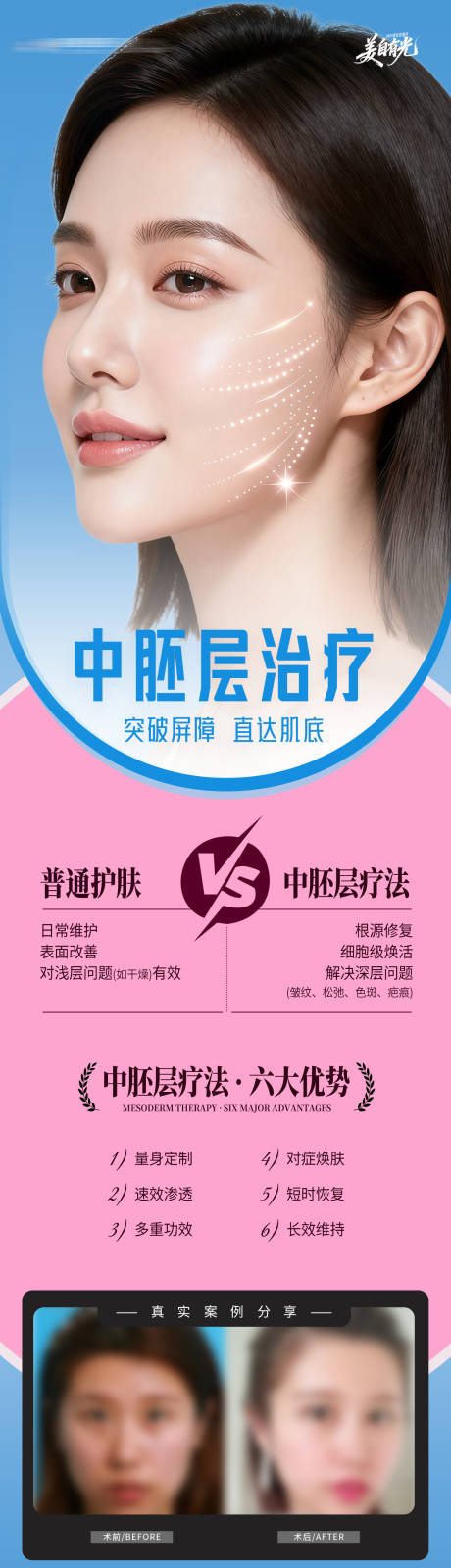 源文件下载【享设计】搜索编号：18010034332824082【医美皮肤中胚层治疗创意案例长图海报】