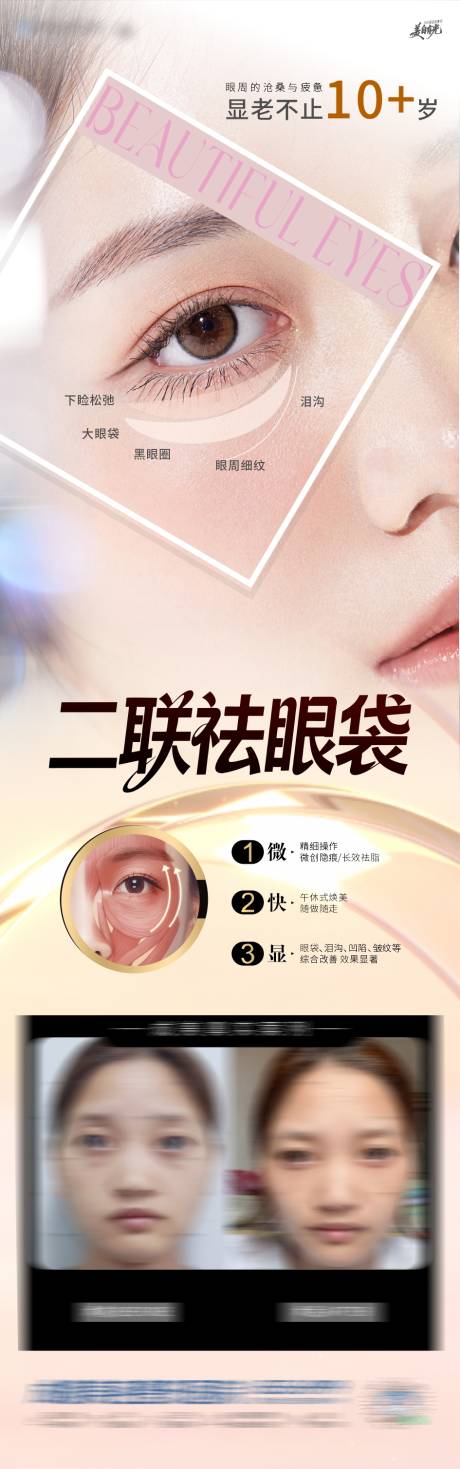 源文件下載【享設(shè)計(jì)】搜索編號(hào)：74460034609102049【醫(yī)美祛眼袋海報(bào)】