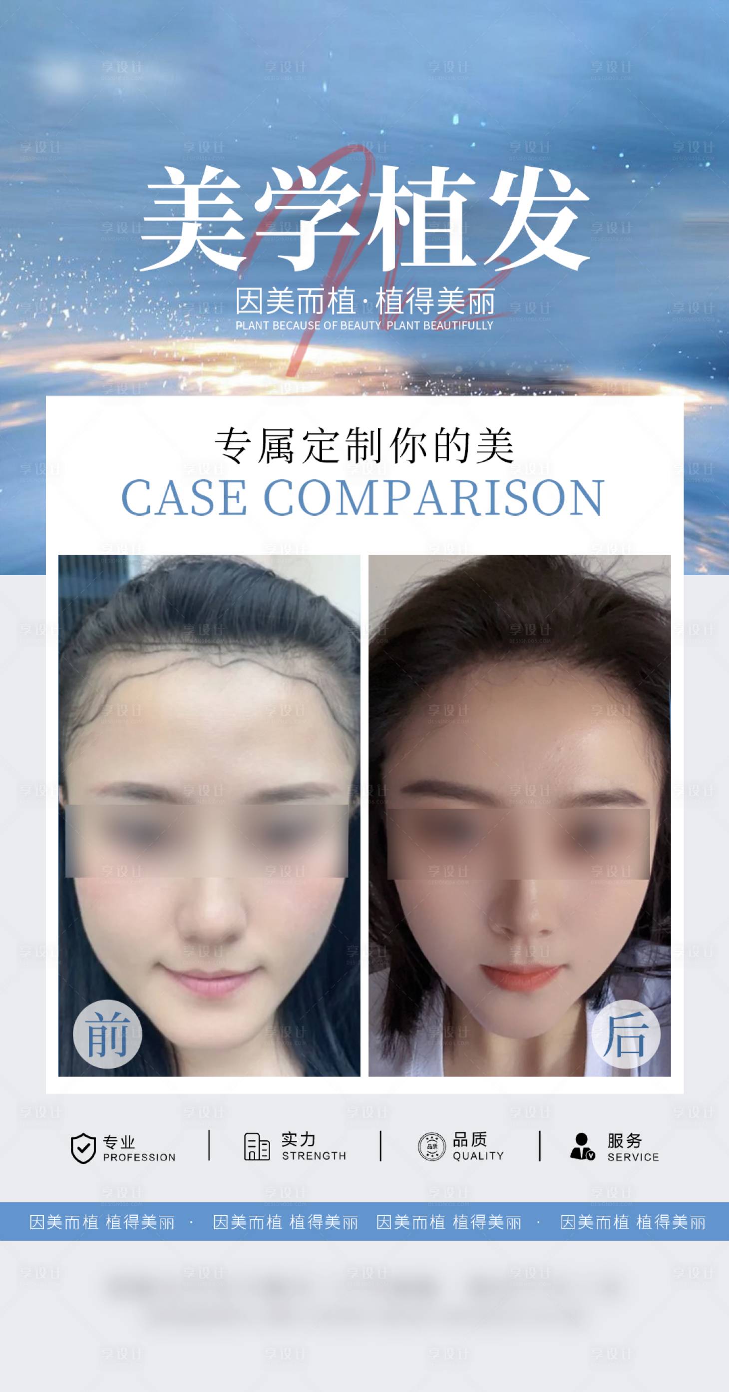 源文件下载【享设计】搜索编号：39200034616087843【医美头皮案例海报】