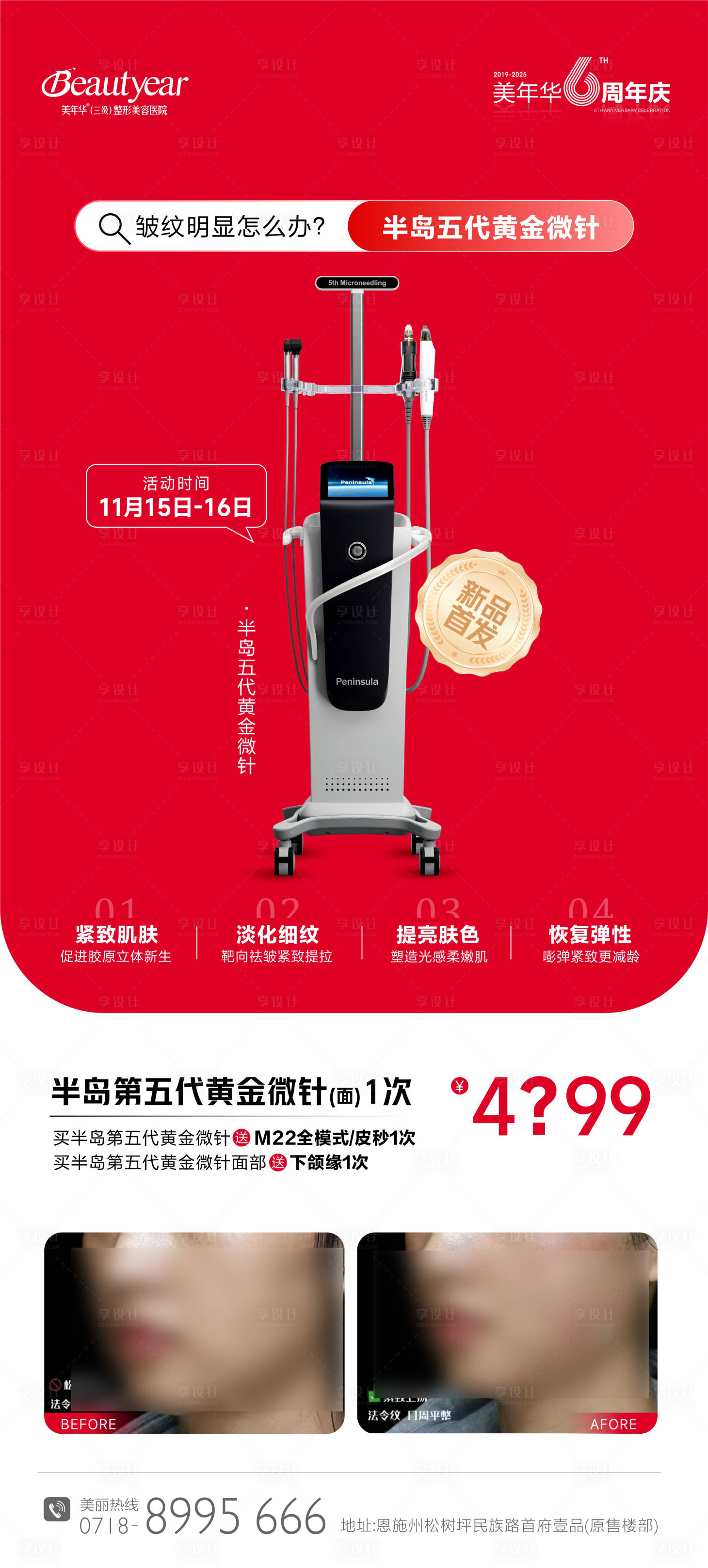 源文件下载【享设计】搜索编号：48410034620264885【光电仪器半岛黄金微针】