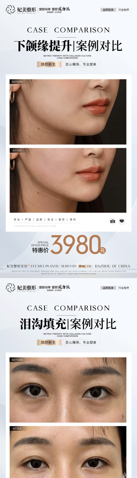 源文件下載【享設(shè)計(jì)】搜索編號(hào)：39840034577571777【美業(yè)案例對(duì)比】