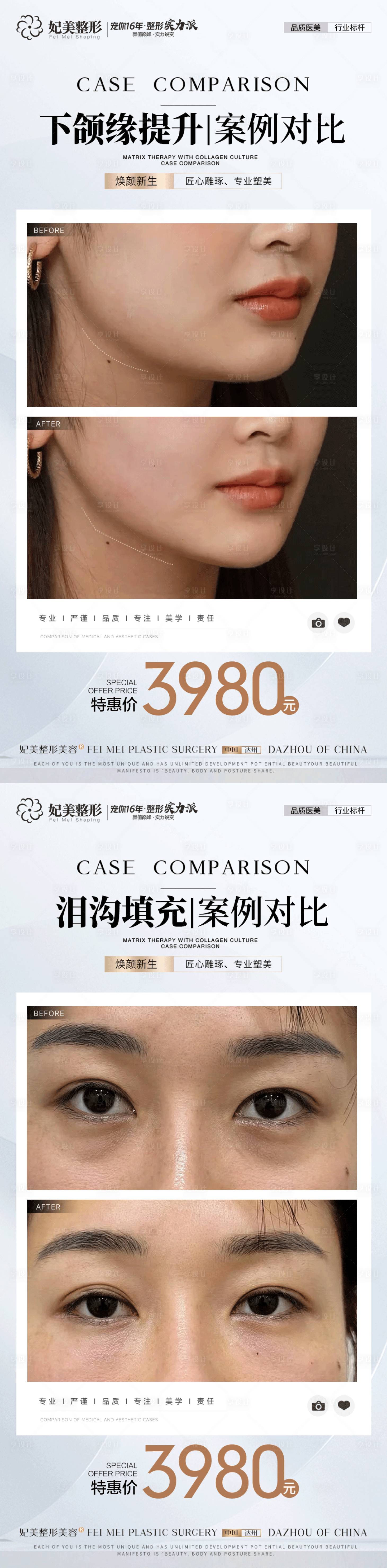 源文件下載【享設計】搜索編號：39840034577571777【美業案例對比】