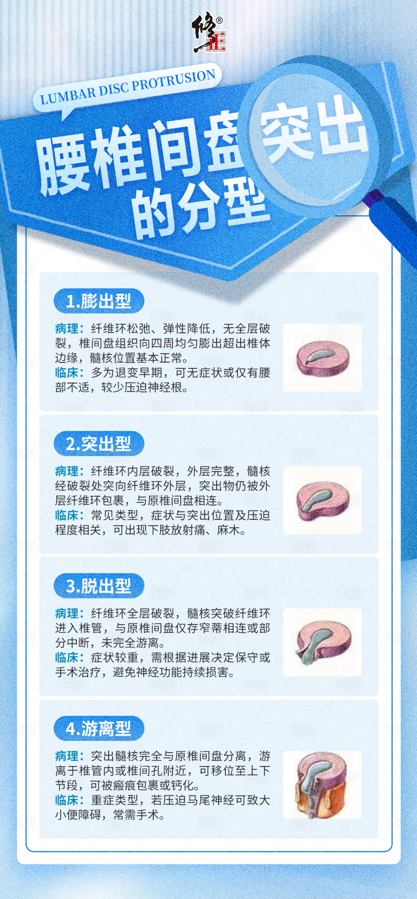 源文件下载【享设计】搜索编号：61340034221045892【腰椎间盘突出科普海报】