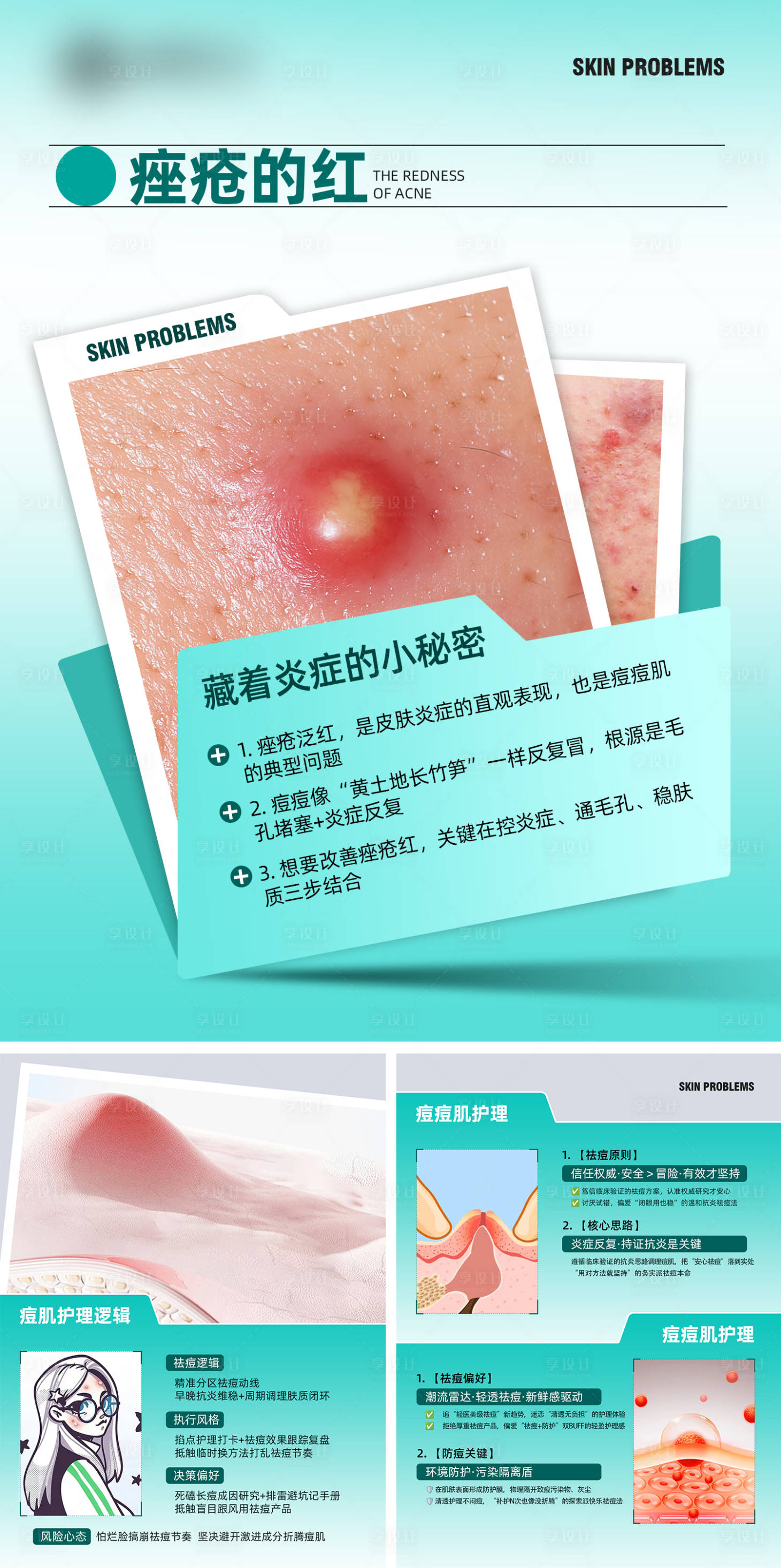 源文件下载【享设计】搜索编号：28050034645778036【痤疮的红科普】