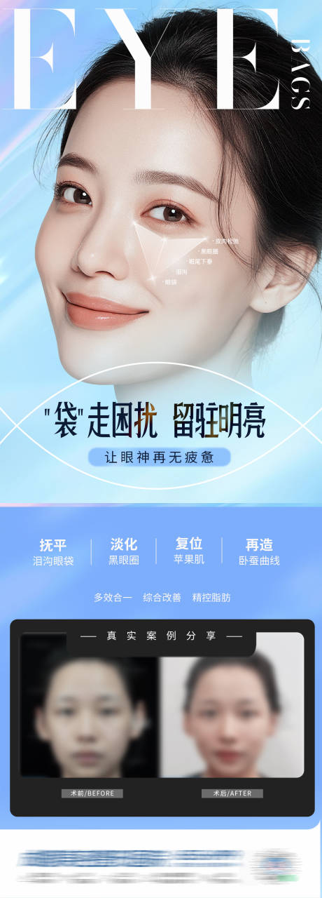 源文件下载【享设计】搜索编号：66670034639417136【医美午休式祛眼袋案例创意海报】