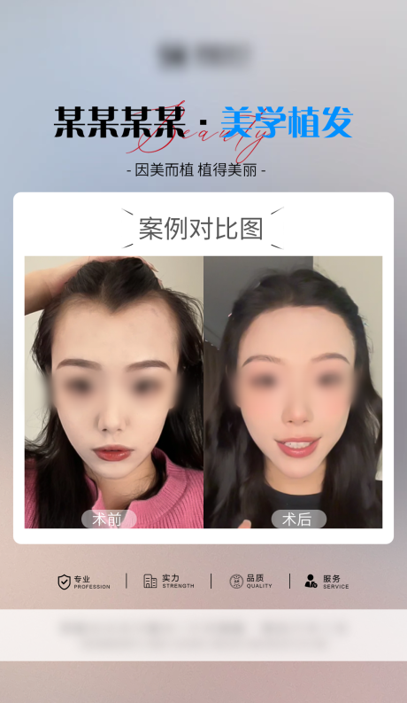 源文件下載【享設計】搜索編號：90430034542159267【醫美頭皮案例海報】