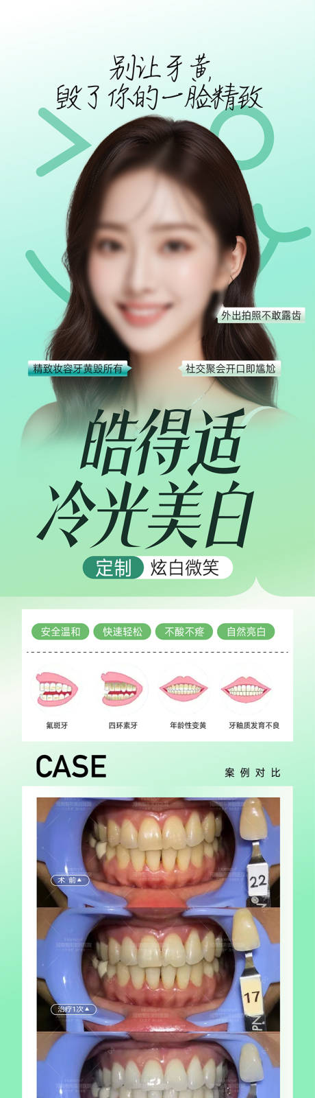 源文件下载【享设计】搜索编号：28620034449286061【口腔美白长图海报  】