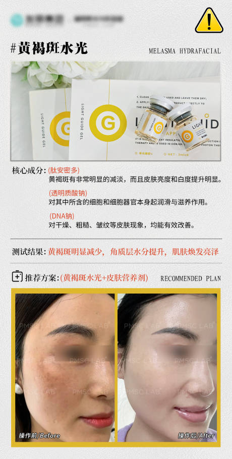 源文件下载【享设计】搜索编号：27640034351117798【关注肌肤透亮案例】