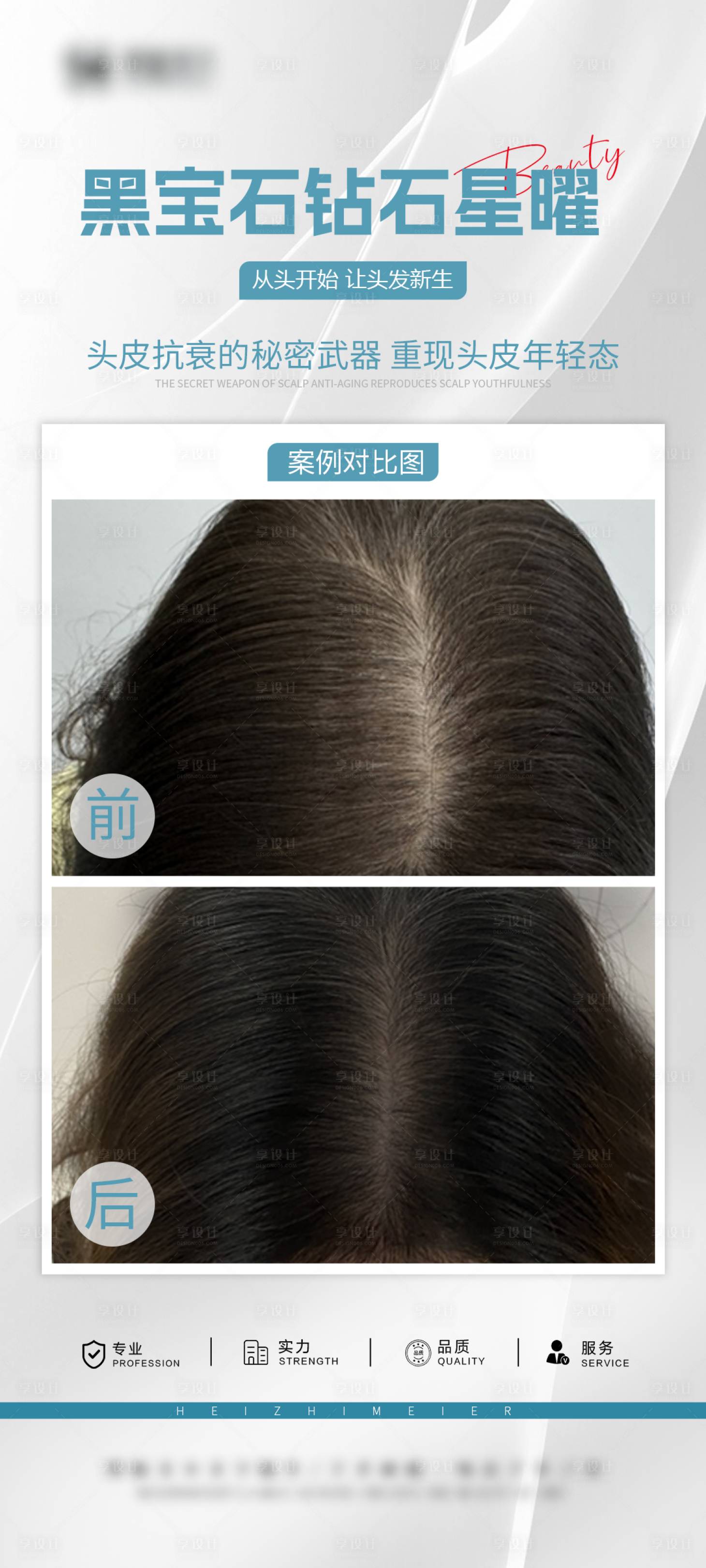 源文件下载【享设计】搜索编号：25200034494294923【医美头皮抗衰案例海报】