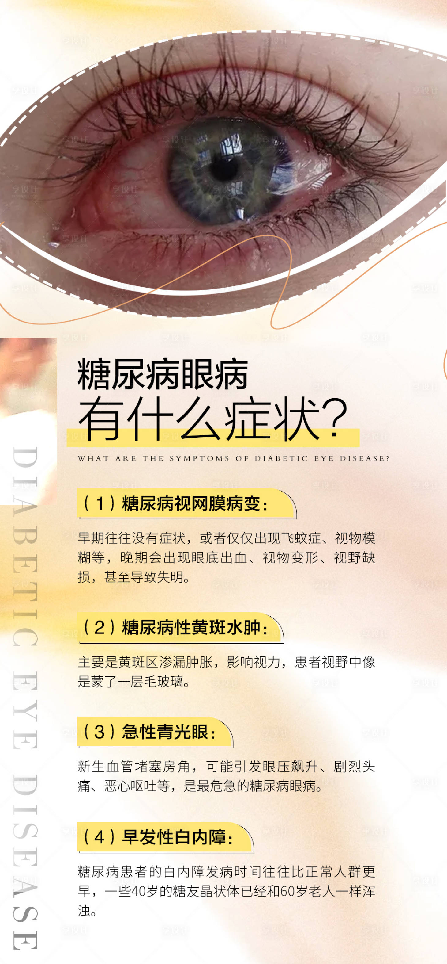 源文件下载【享设计】搜索编号：96310034488046268【眼睛名目眼病健康科普品牌宣传海报】