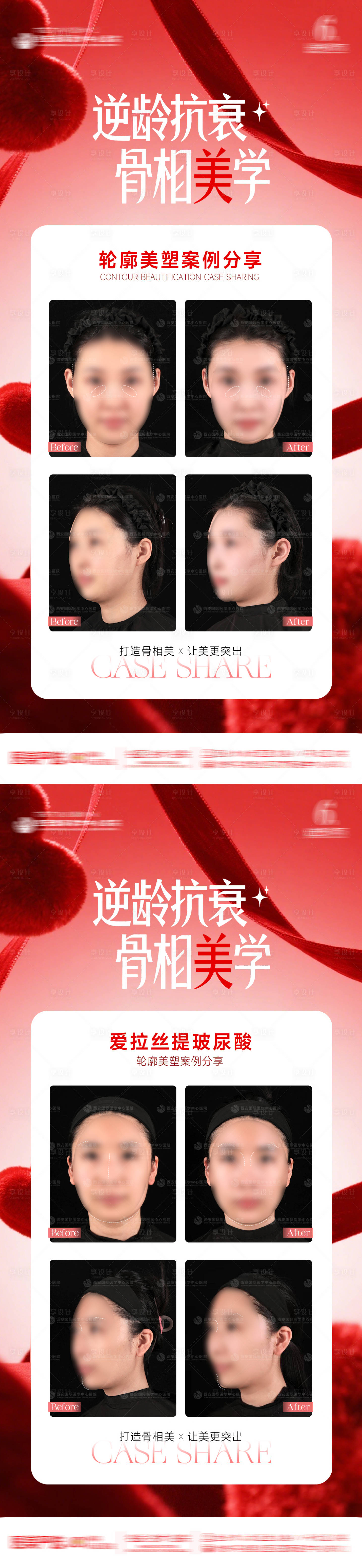 源文件下载【享设计】搜索编号：54300034358165813【医美整形抗衰轮廓案例逆龄抗衰骨相美学】