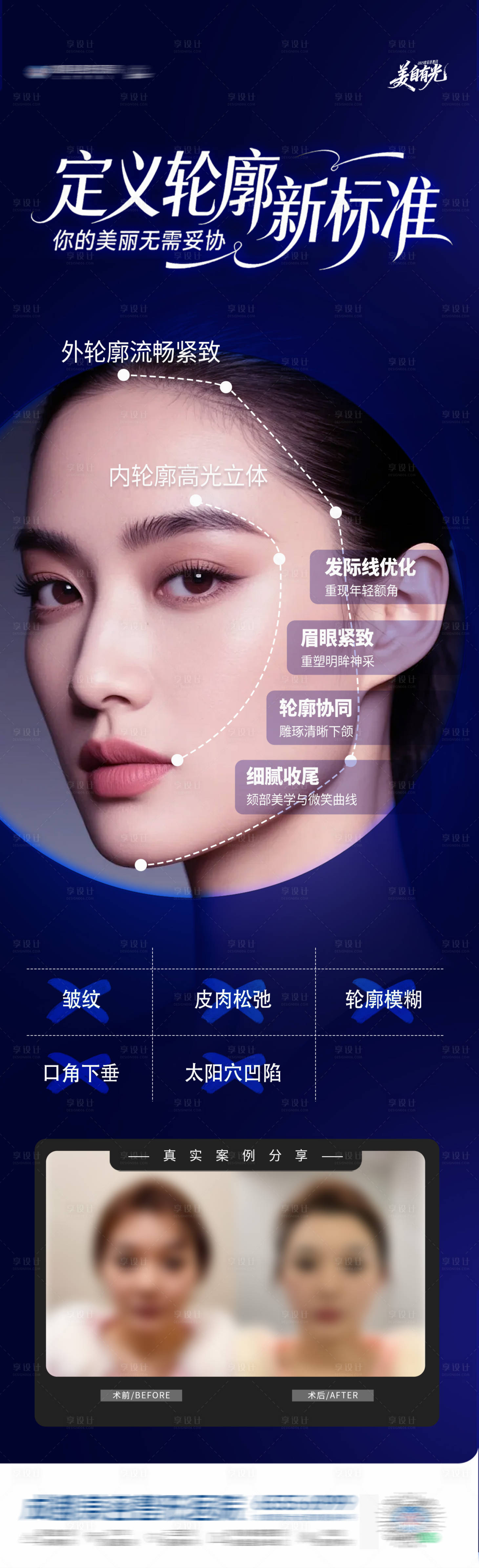 源文件下载【享设计】搜索编号：52070034529422319【医美内外轮廓全面部提升案例创意海报】