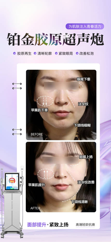 源文件下载【享设计】搜索编号：91920034631124401【胶原超声炮海报】