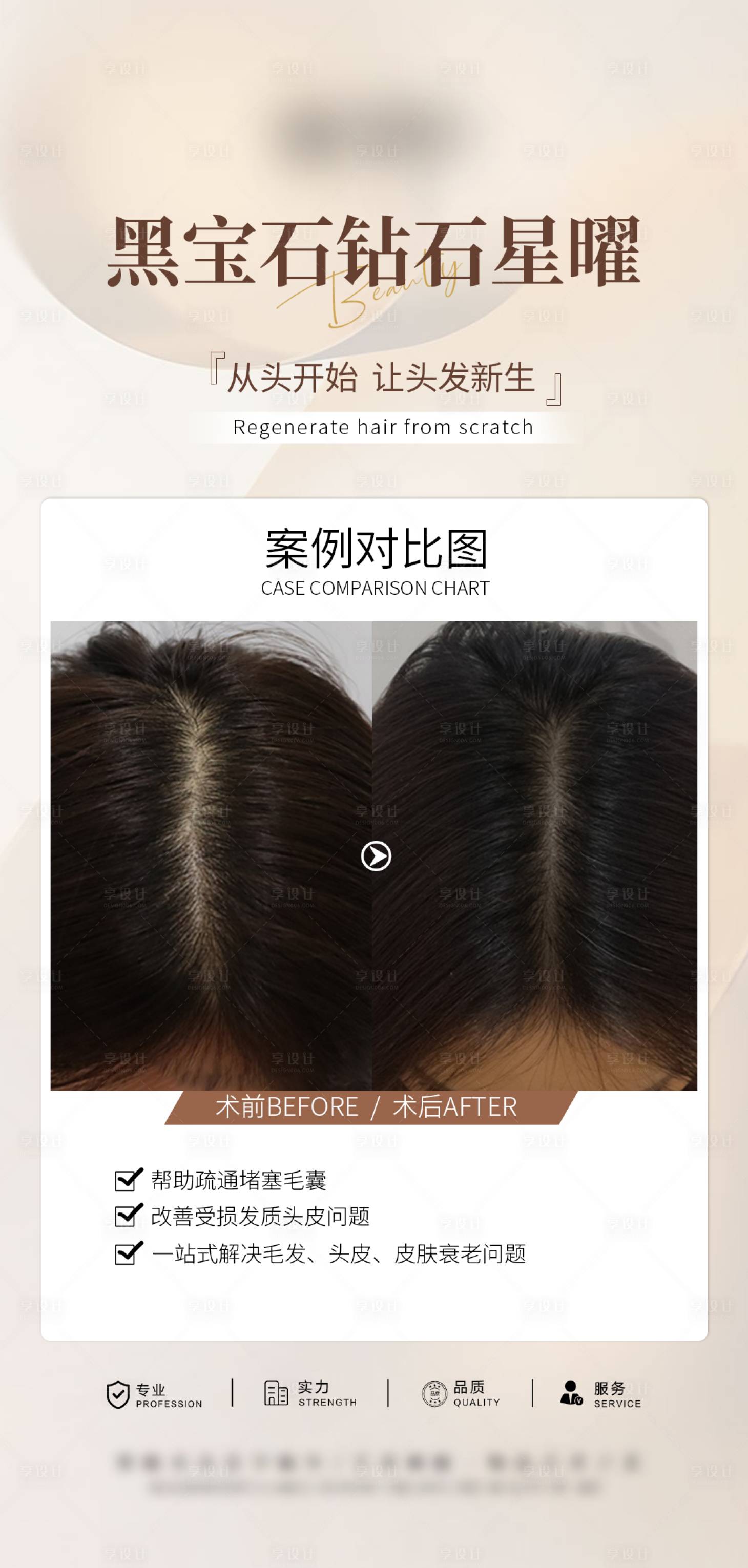 源文件下载【享设计】搜索编号：74280034473943230【医美头皮抗衰案例海报】