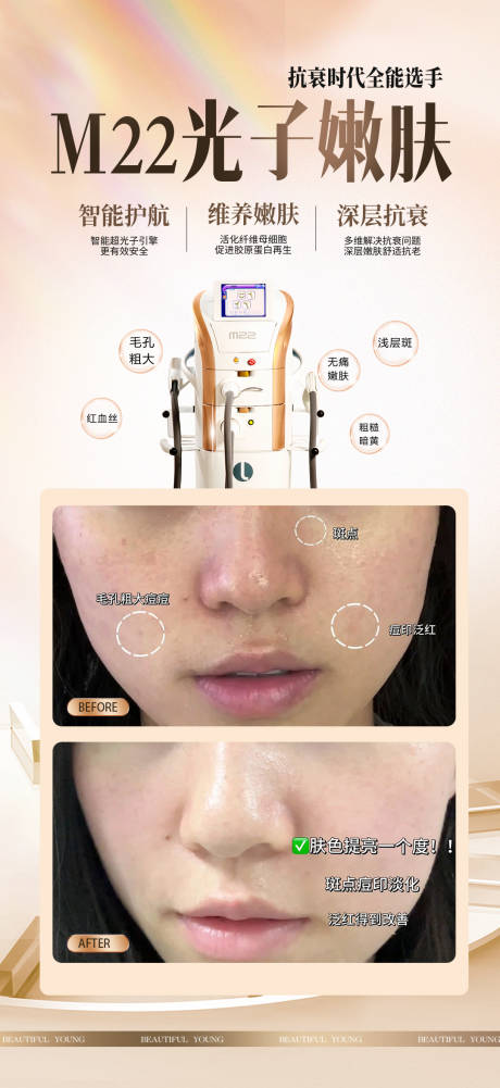 源文件下載【享設(shè)計(jì)】搜索編號(hào)：93150034290426419【光子嫩膚案例】