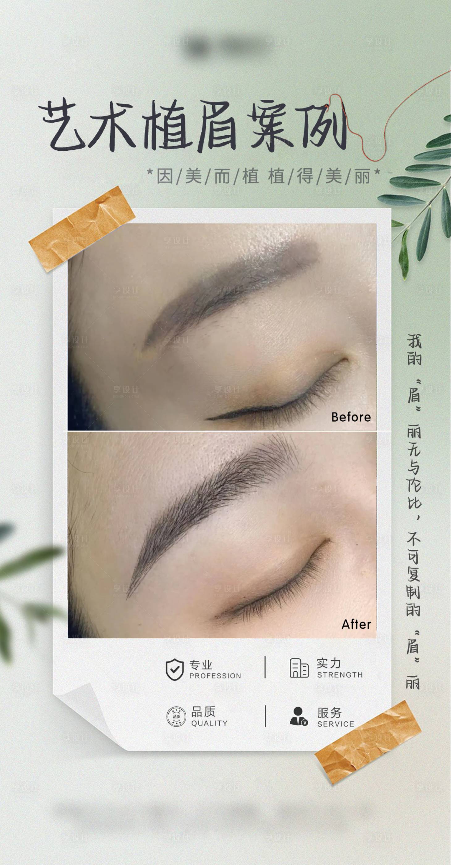 源文件下载【享设计】搜索编号：38020034635153580【医美艺术植眉案例海报】