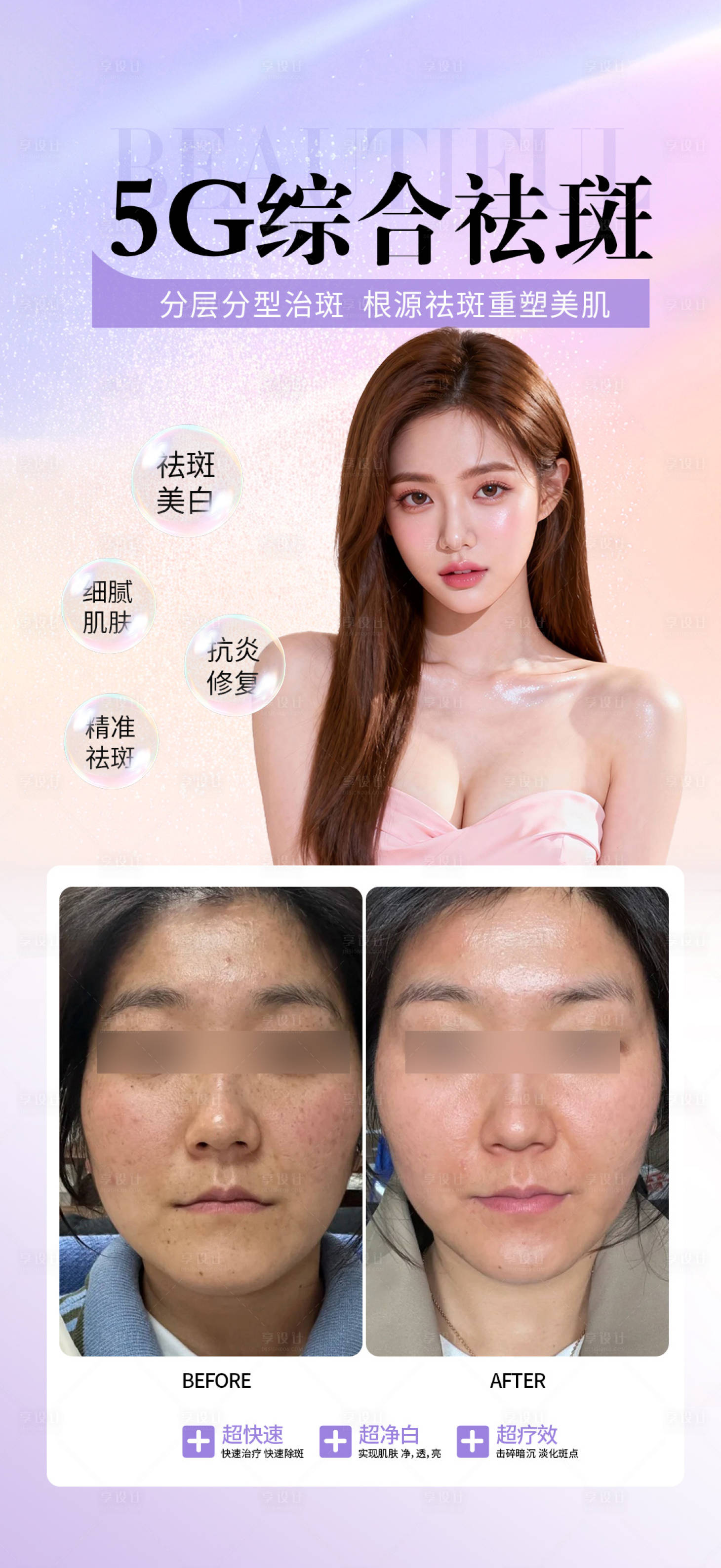 源文件下载【享设计】搜索编号：30240034427104399【5G综合祛斑】