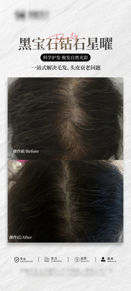 源文件下載【享設計】搜索編號：47110034474469067【醫美頭皮抗衰案例海報】