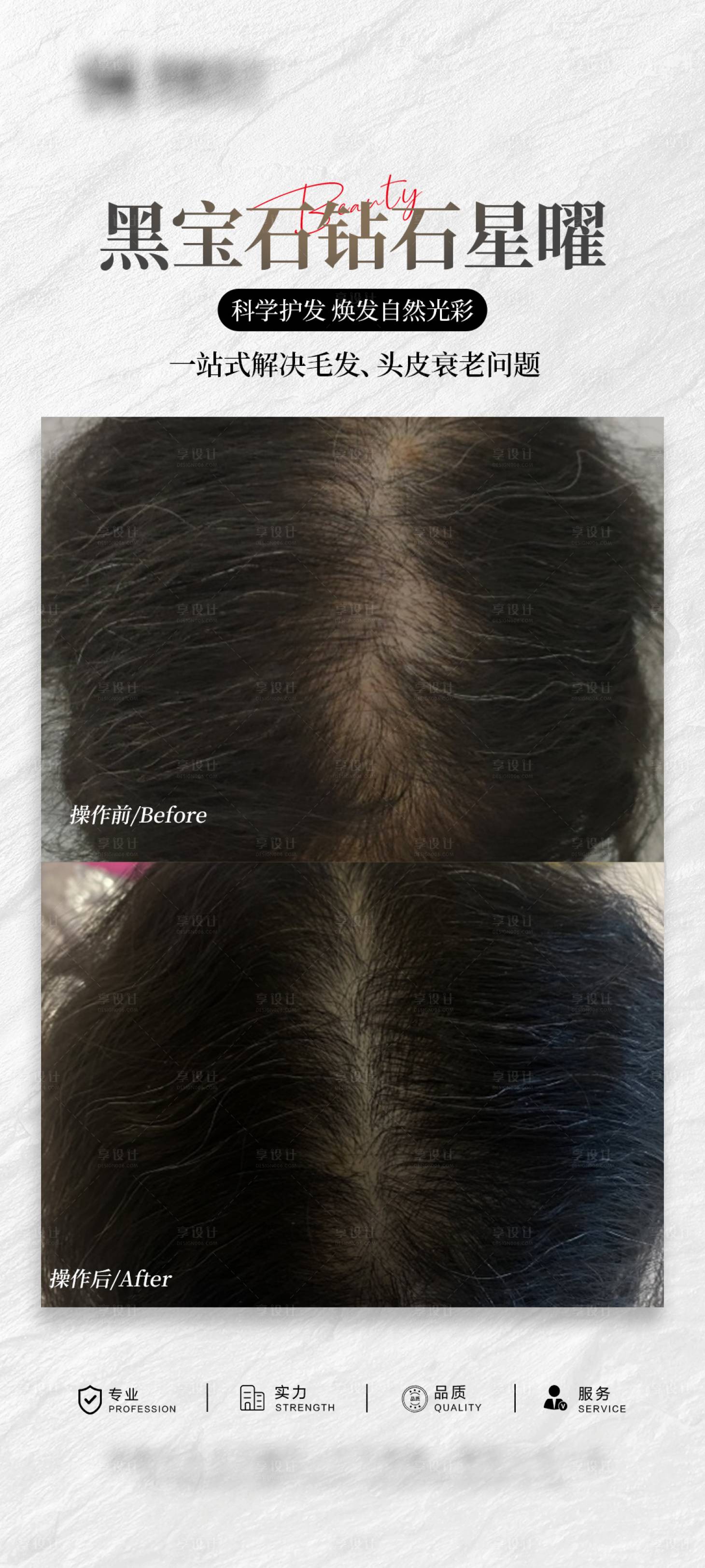 源文件下载【享设计】搜索编号：47110034474469067【医美头皮抗衰案例海报】