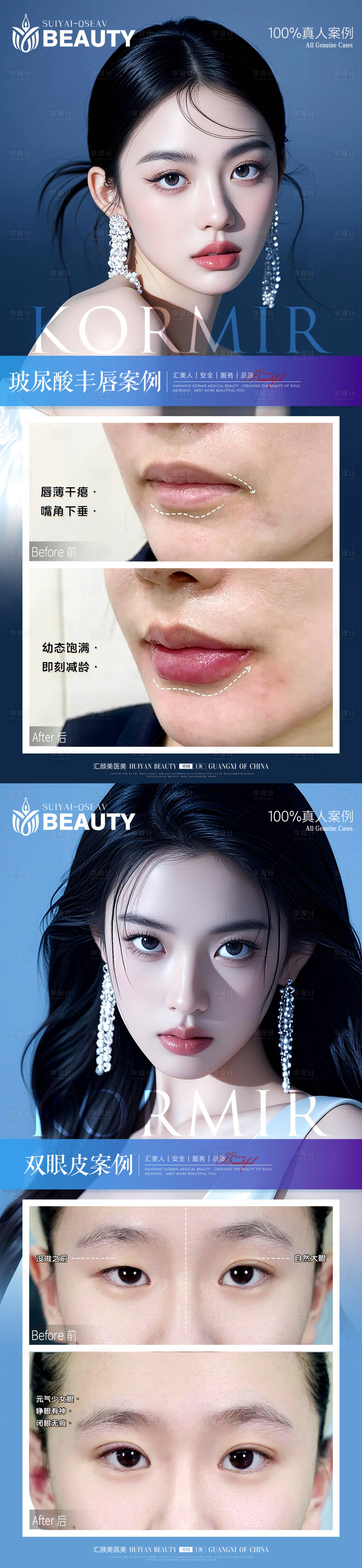 源文件下载【享设计】搜索编号：86350034291511821【医美案例海报】