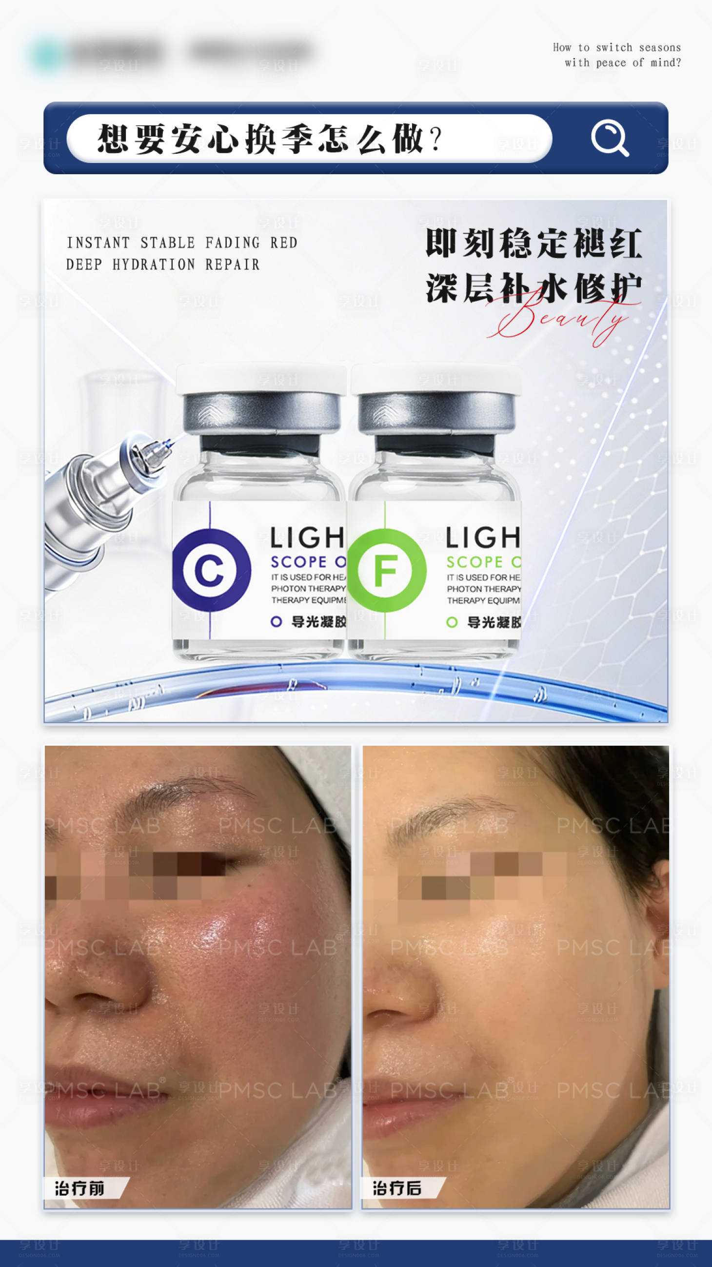 源文件下载【享设计】搜索编号：98660034780996945【医美水光产品案例对比海报】