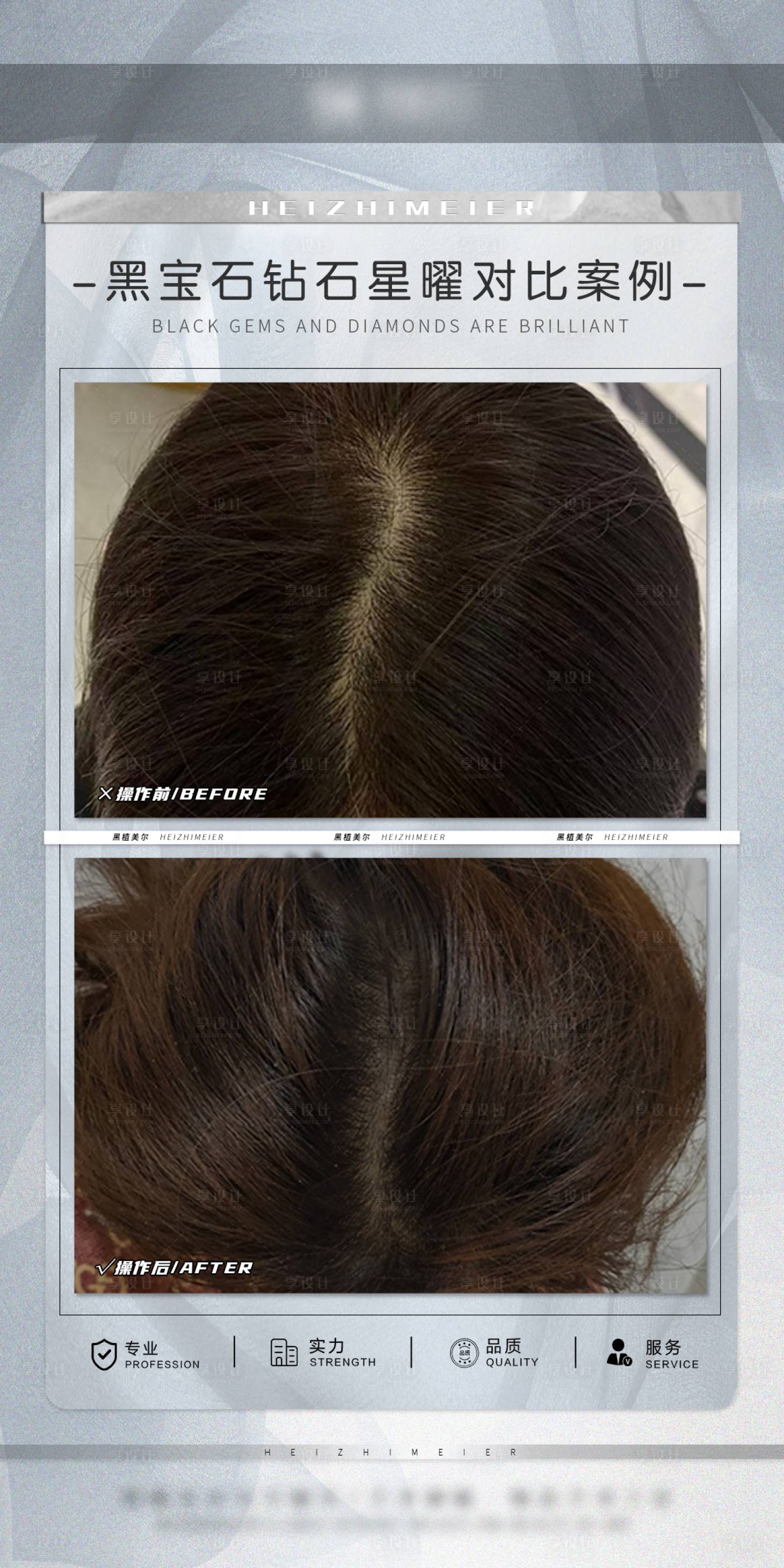 源文件下载【享设计】搜索编号：61930034494227519【医美头皮抗衰案例海报】