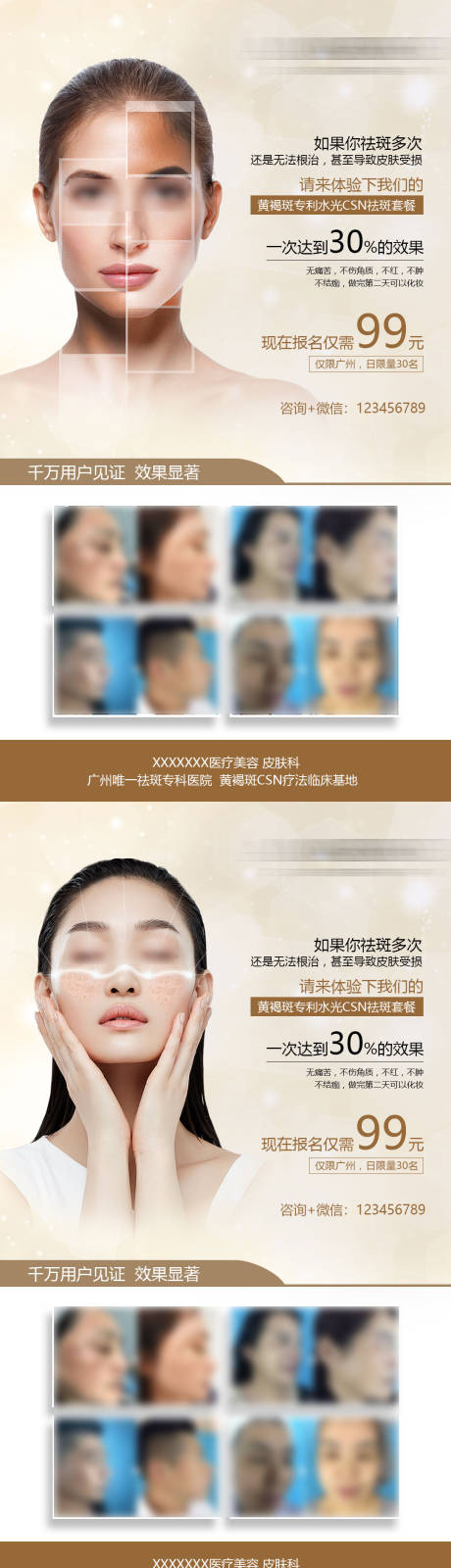 源文件下载【享设计】搜索编号：54160034670431489【医美祛斑体验海报】