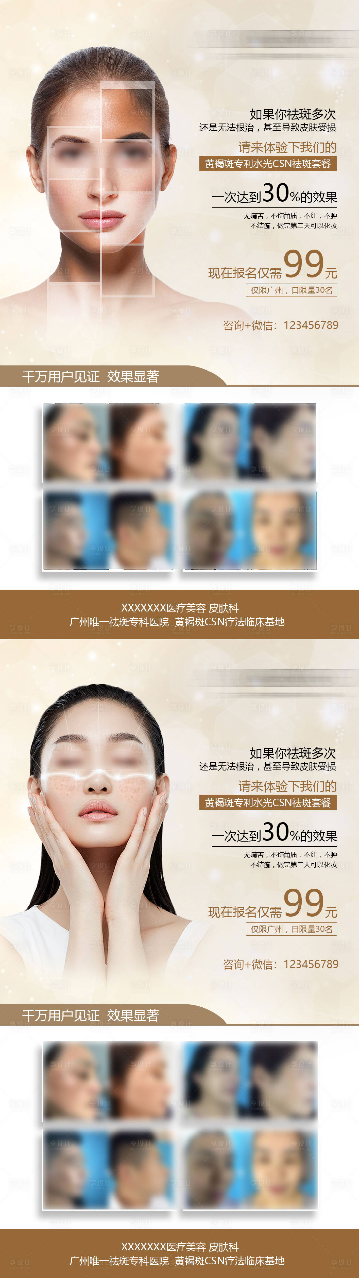 源文件下载【享设计】搜索编号：54160034670431489【医美祛斑体验海报】