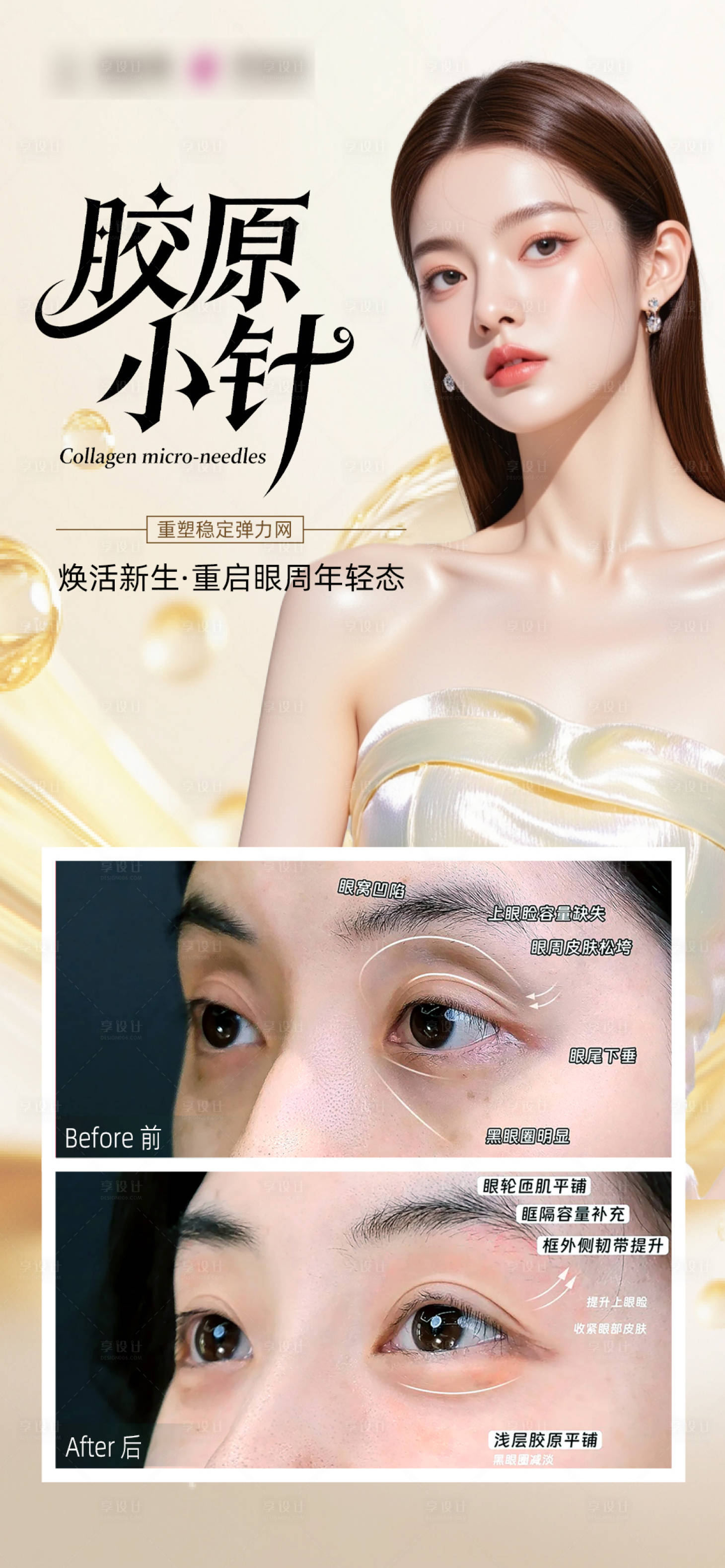 源文件下载【享设计】搜索编号：89110034491442045【胶原小针眼周】