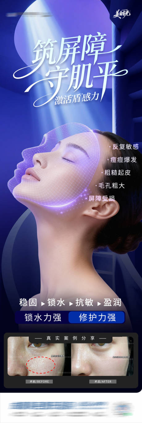 源文件下载【享设计】搜索编号：96670034520908126【医美敏感修复屏障案例对比创意海报】