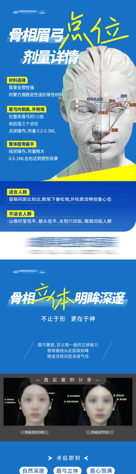 源文件下載【享設計】搜索編號：65090034520445559【醫美骨相眉弓整形塑美科普海報】