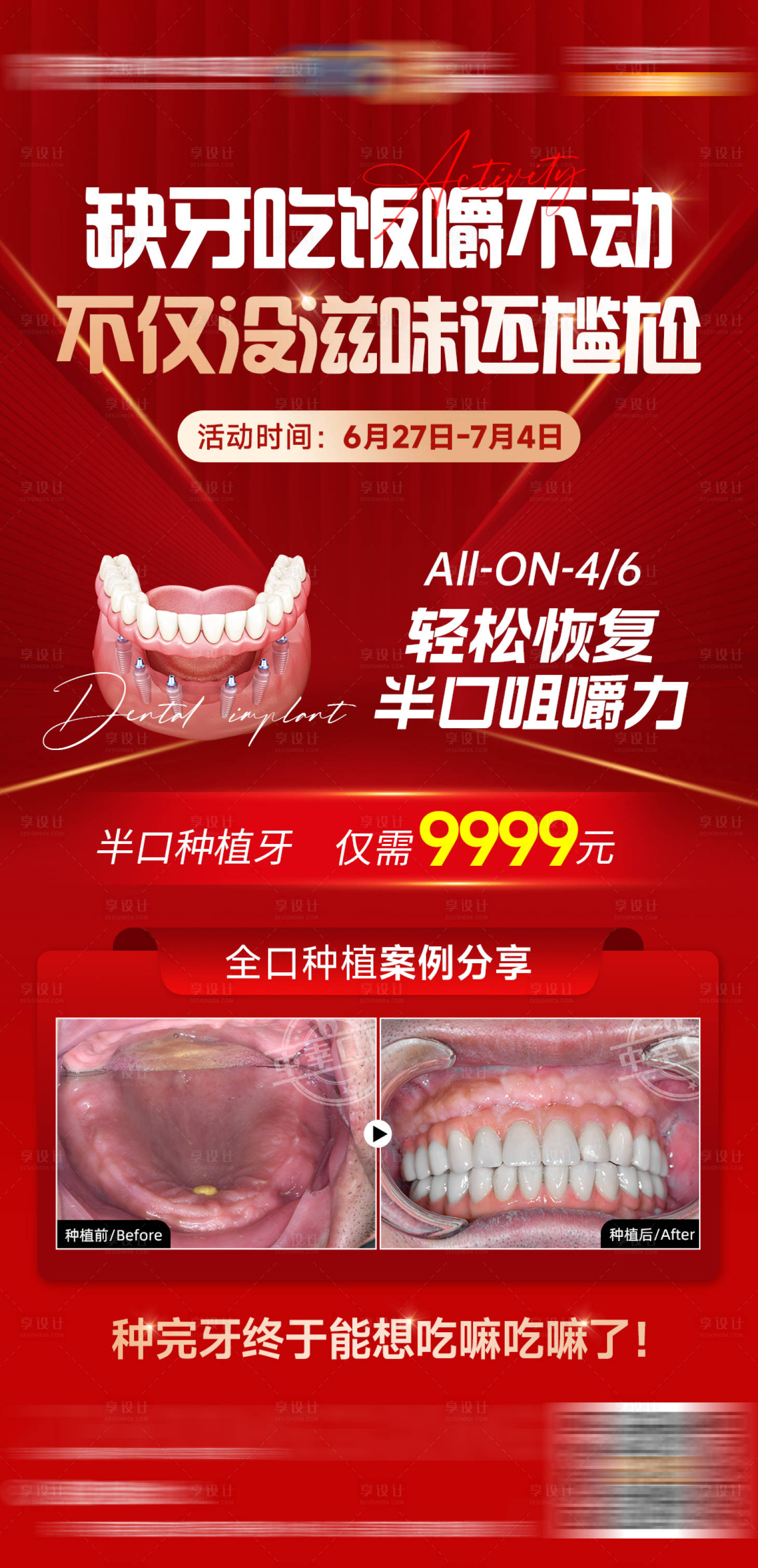 源文件下载【享设计】搜索编号：24800034589098622【缺牙活动海报】