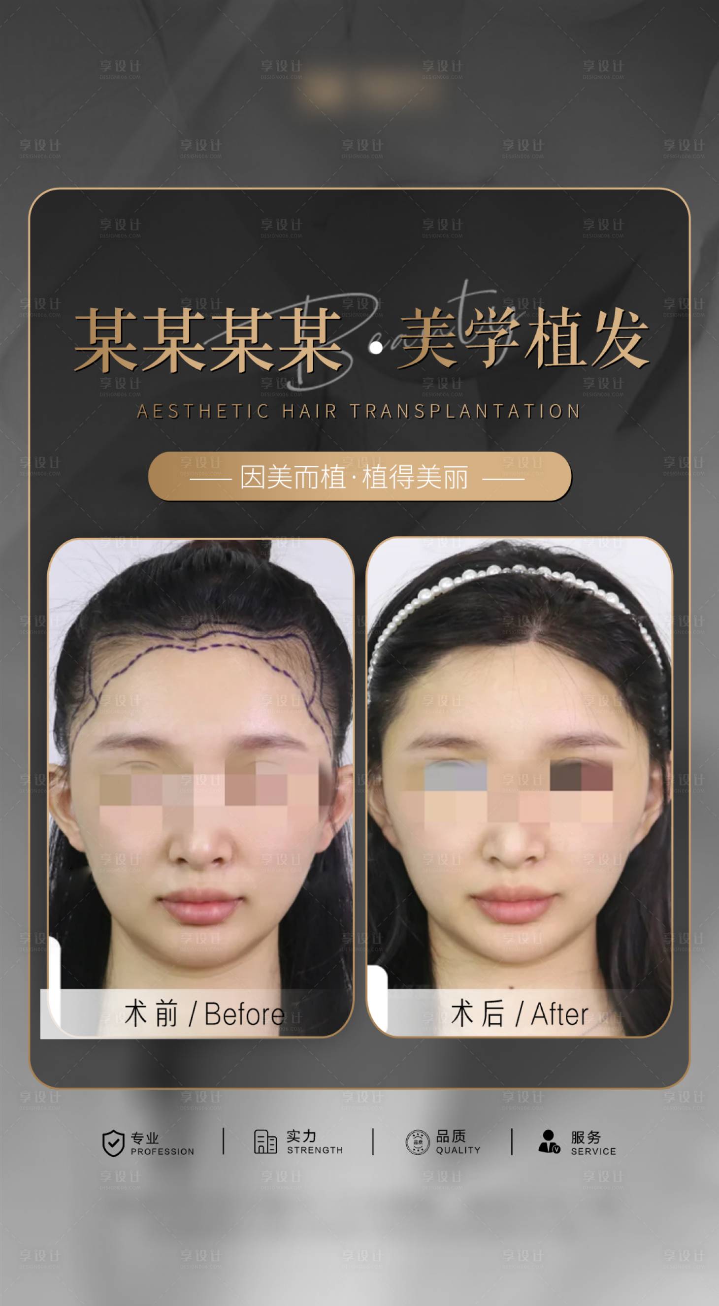 源文件下载【享设计】搜索编号：18810034616064182【医美头皮案例海报】