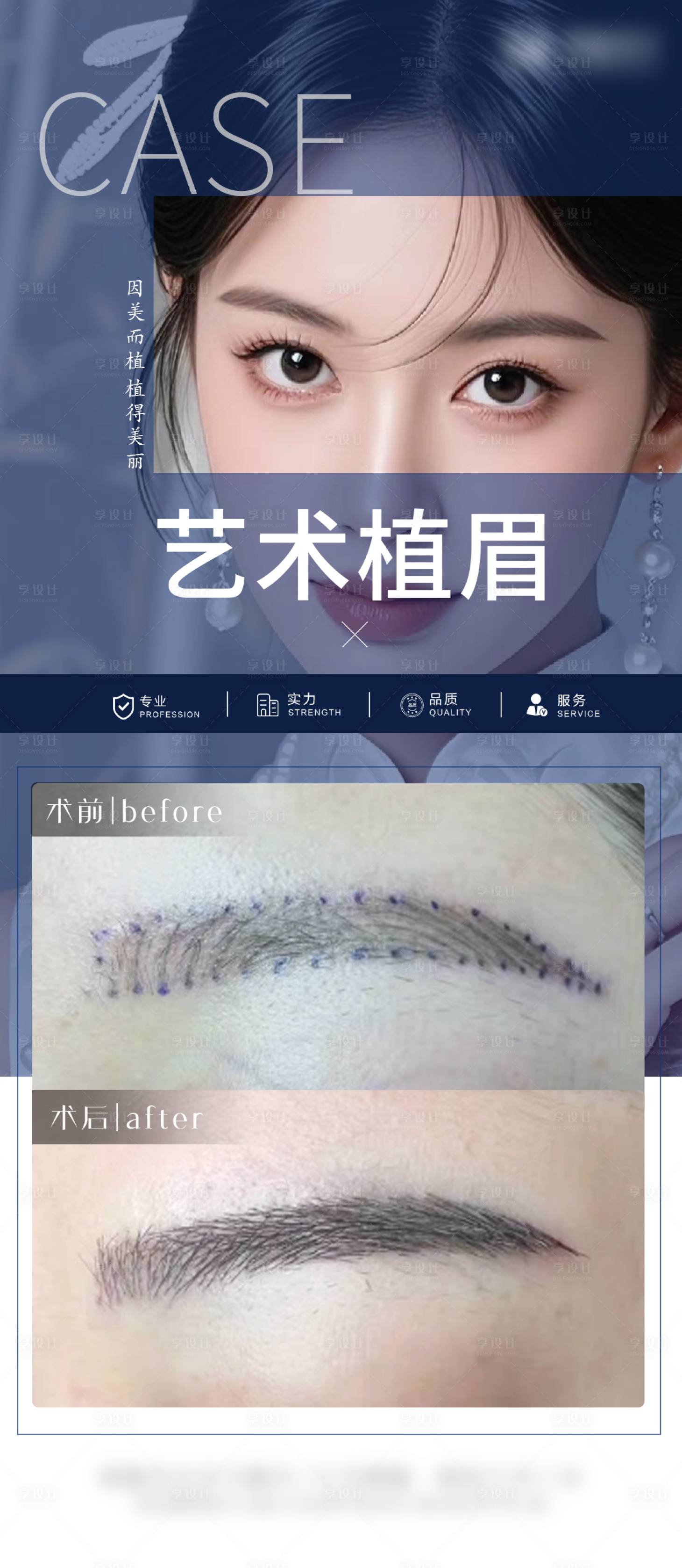 源文件下载【享设计】搜索编号：23000034641785669【医美眉毛案例海报】