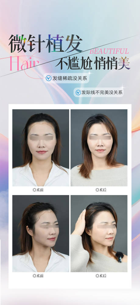 源文件下载【享设计】搜索编号：90940034799821956【微针植发案例宣传海报】