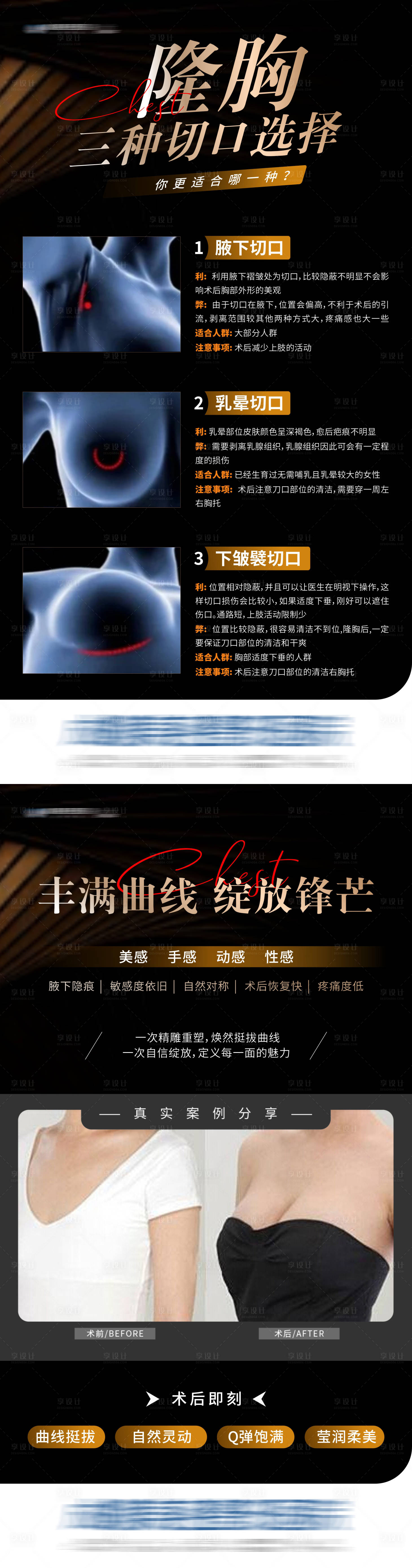 源文件下载【享设计】搜索编号：79690034386754842【医美隆胸丰胸三种切口科普案例创意海报】