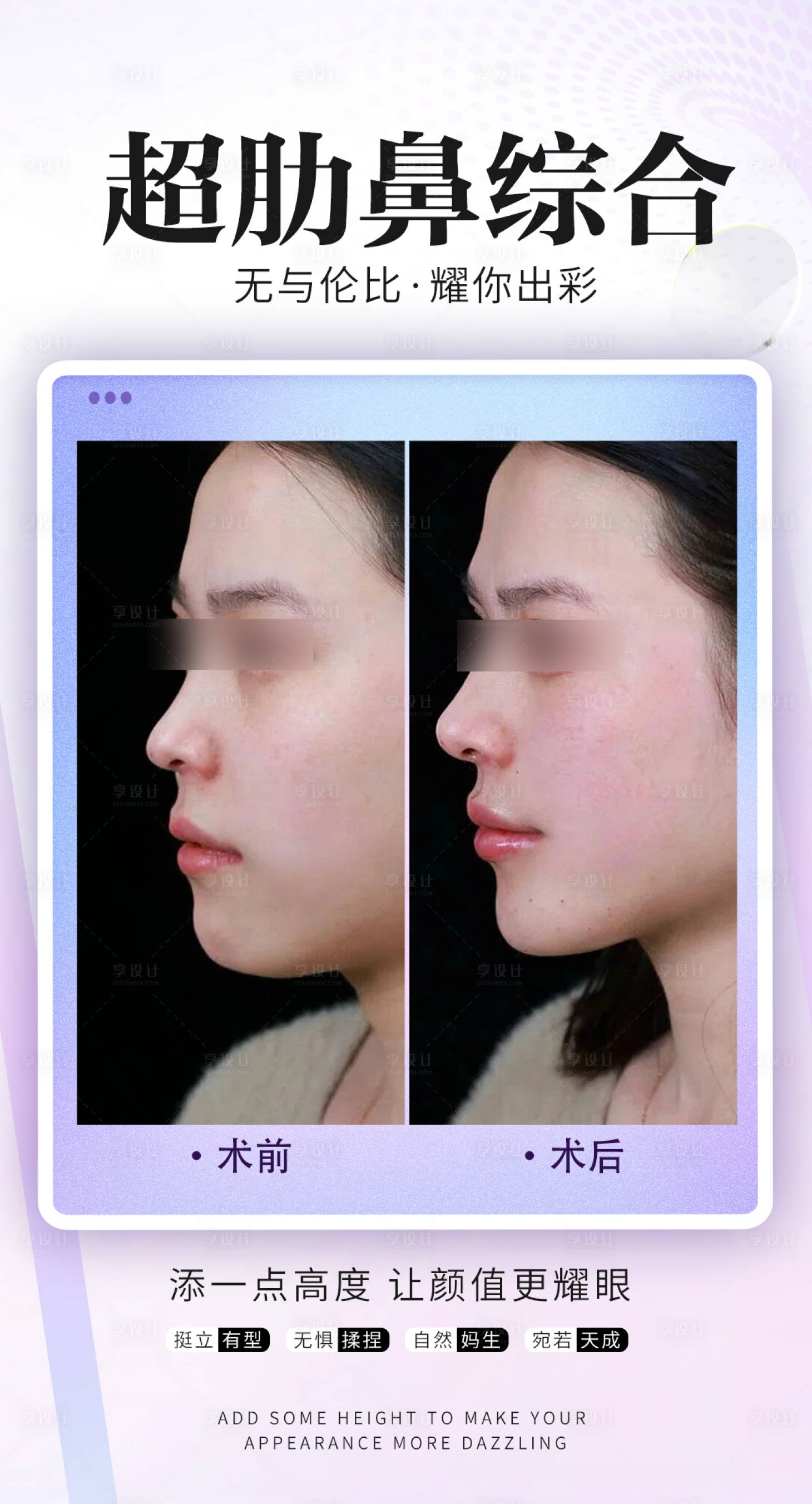 源文件下载【享设计】搜索编号：14700034769585310【超肋鼻综合】