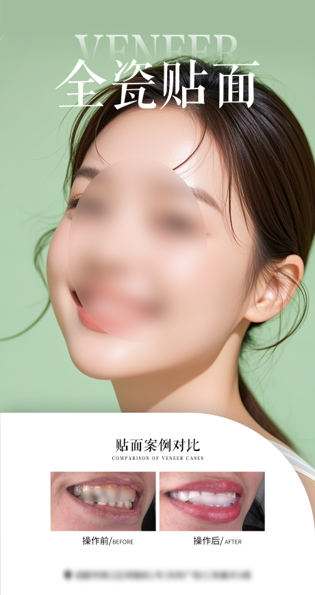 源文件下载【享设计】搜索编号：32450034448592744【口腔案例海报】