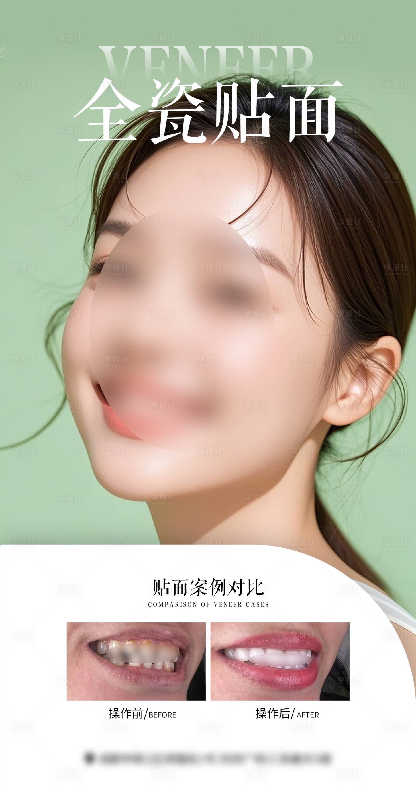 源文件下载【享设计】搜索编号：32450034448592744【口腔案例海报】