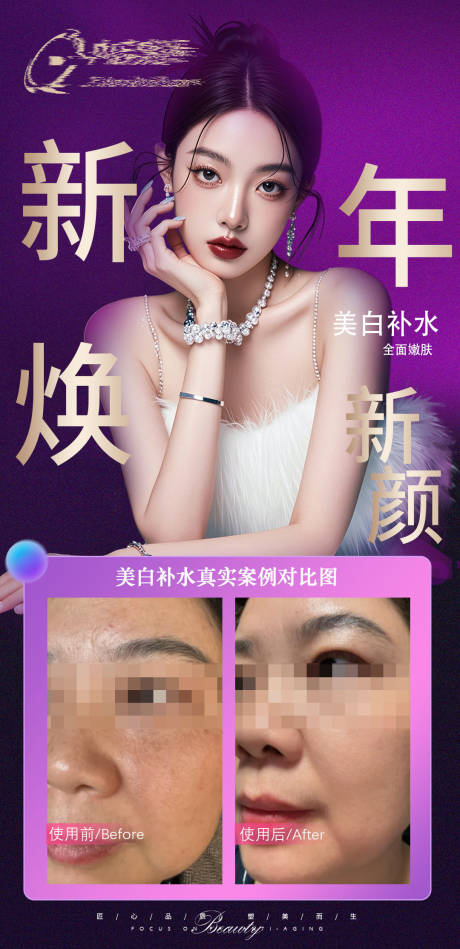 源文件下载【享设计】搜索编号：78900034556155356【美白补水美肤案例海报对比图】