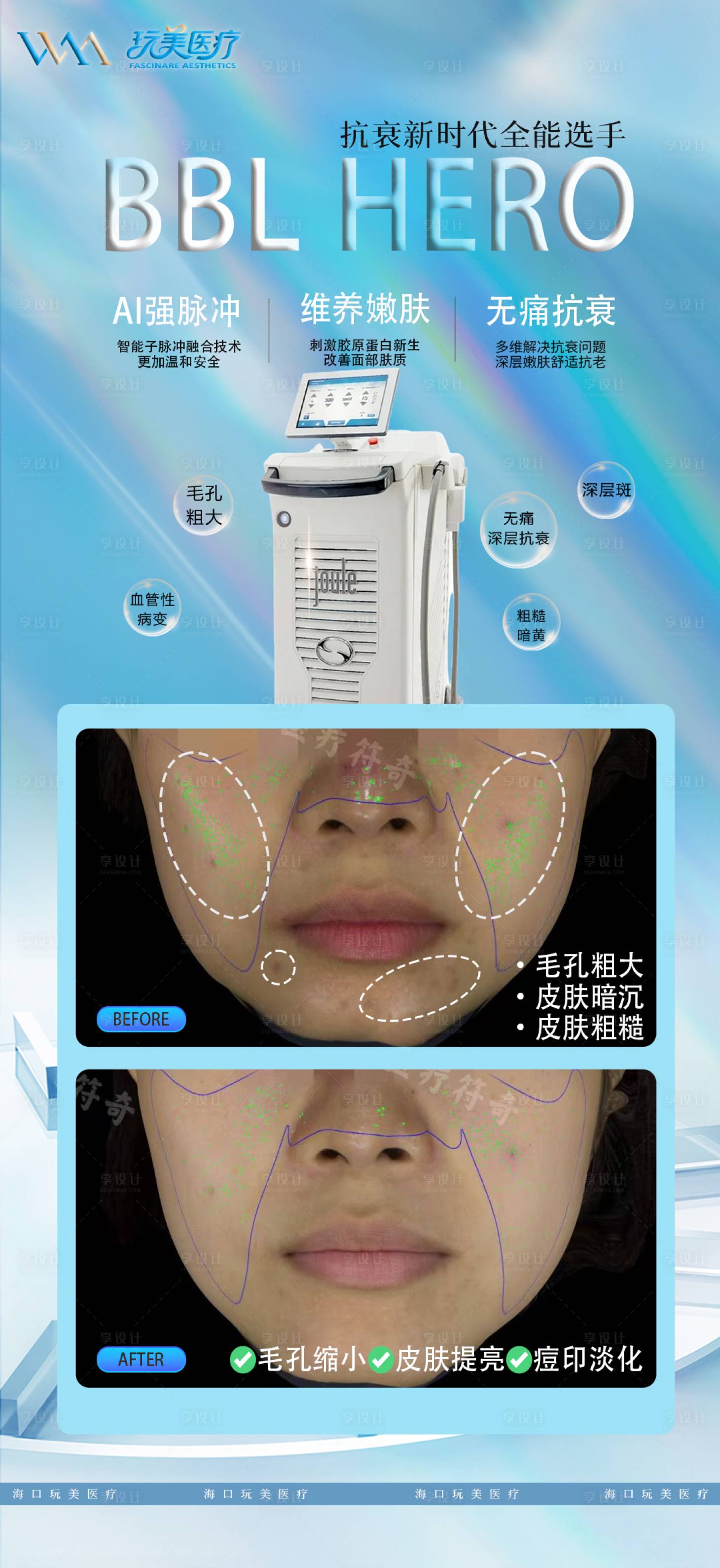 源文件下载【享设计】搜索编号：46680034668522852【光子嫩肤对比图海报】