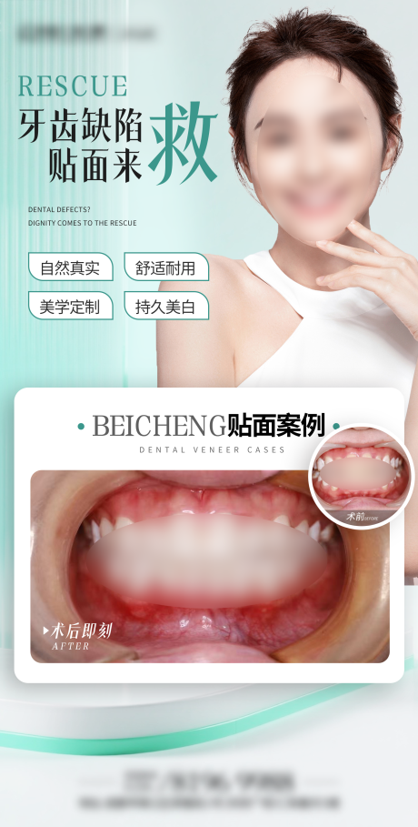 源文件下载【享设计】搜索编号：59720034308874642【口腔医美案例海报】