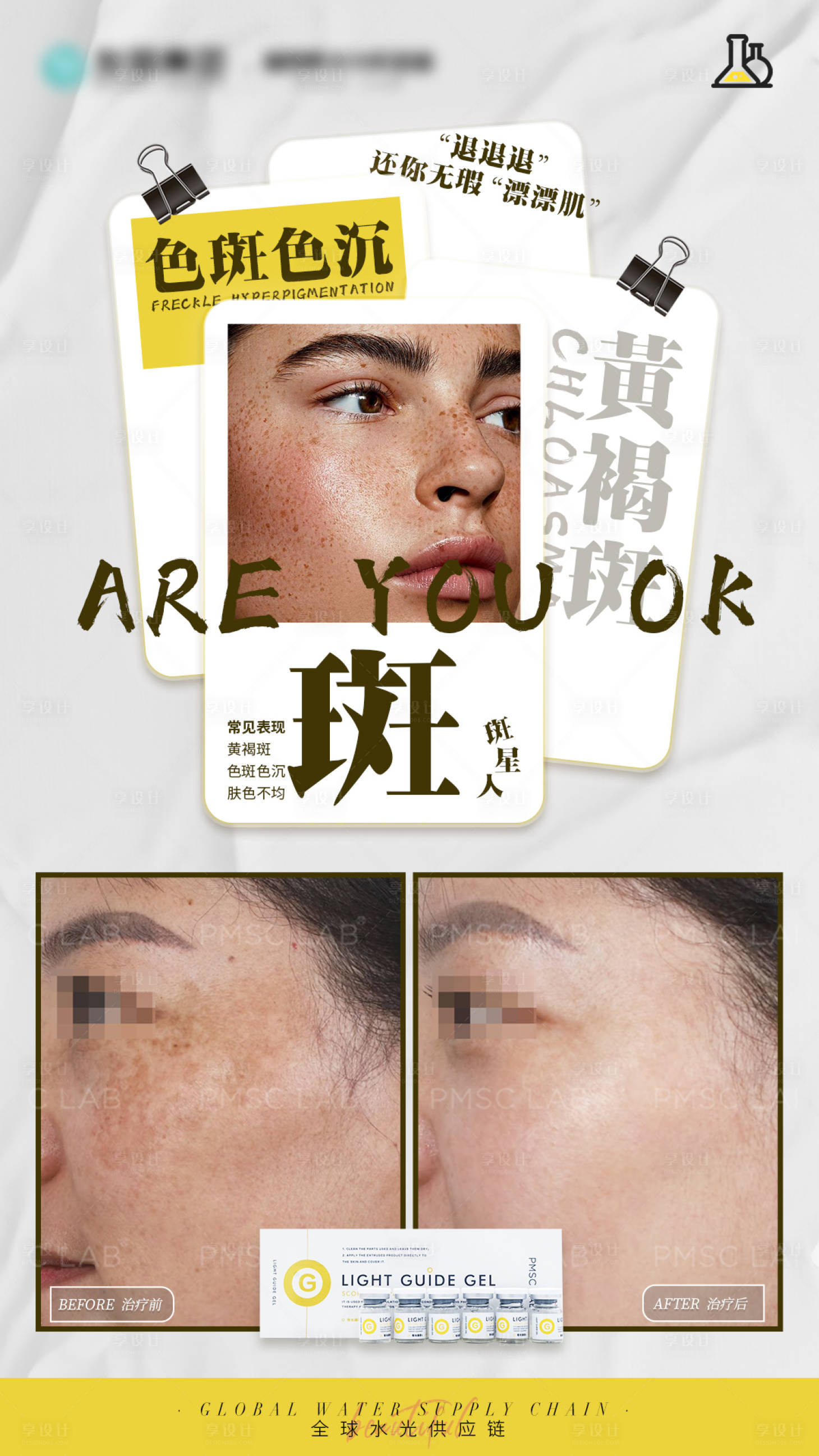 源文件下载【享设计】搜索编号：12150034457018593【医美色斑案例对比海报】